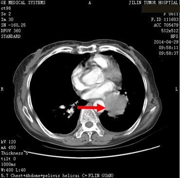 208324e26b0a3f74784a5d2a4ac1c943.jpg 10.jpg