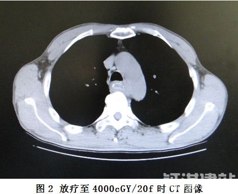 41c71dca8d54e3831b0135acd4128ea0.jpg 11.jpg