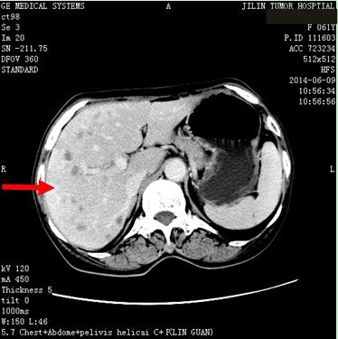 6576fba418f0eec68e09ffab576e2c78.jpg 11.jpg