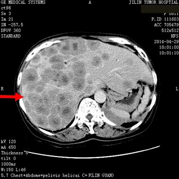 97c1123ecacd3035edba2f8a4d66fb8e.jpg 10.jpg