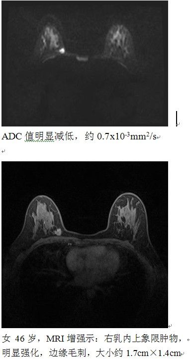 f438f582f49b730366b3a2c74f0d61e9.jpg 10.jpg..jpg