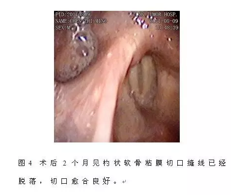 1cc18686dda00207517b10bcd16f91a4.png 13.png