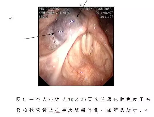 3f299b3d3c457cf71b8c5ab9bcef180b.png 10.png