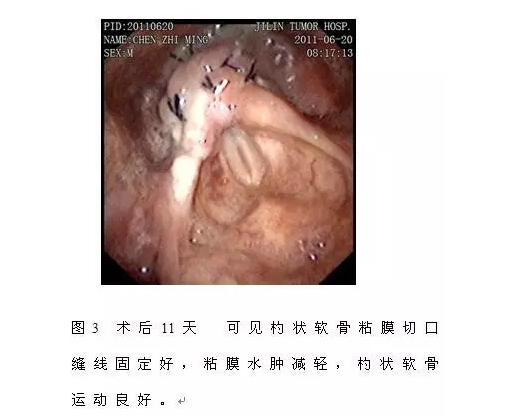 6bf9d16c5dfdd074c6d8d7e04ebd8248.png 12.png