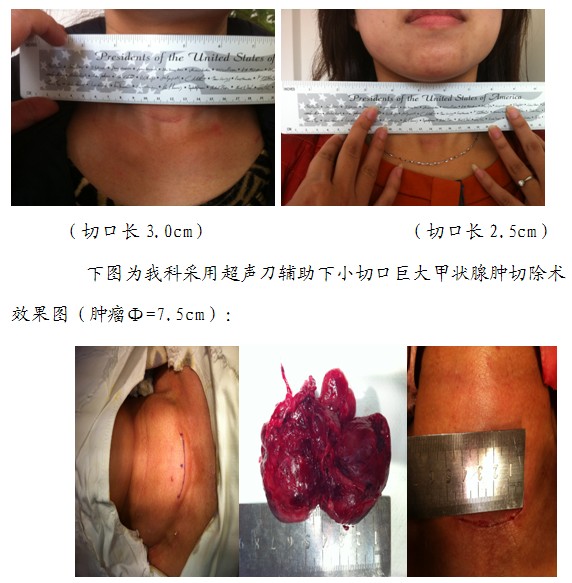 c48527f7aaa848b3a0ab5e99c9fc8157.jpg 100.jpg