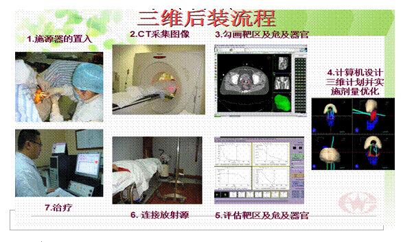 14690b83c0da7cec0f2310105215ef72.jpg 100.jpg