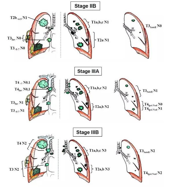 5436a0440365fe0ee691d28080b8a13a.jpg 11.jpg