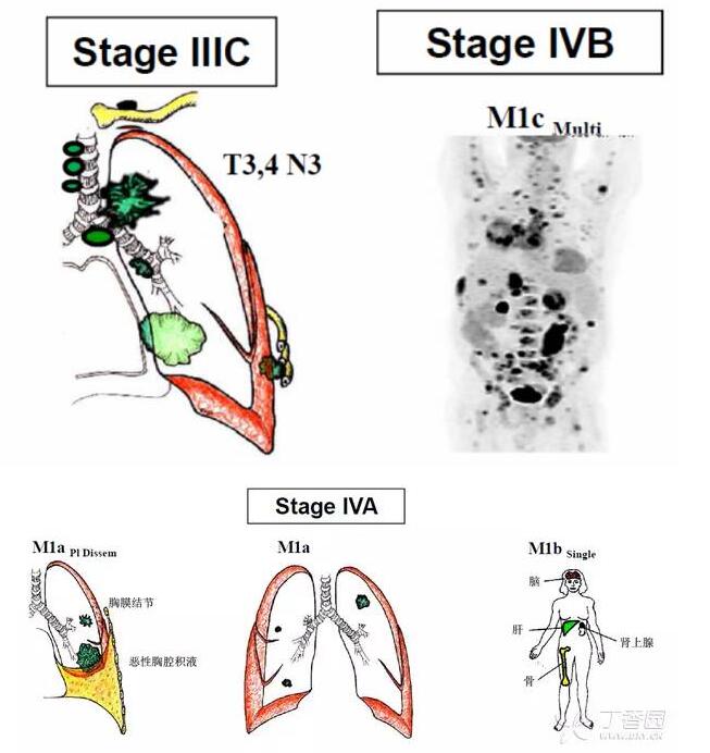 b567c558912942482e8fc464c12cf008.jpg 12.jpg