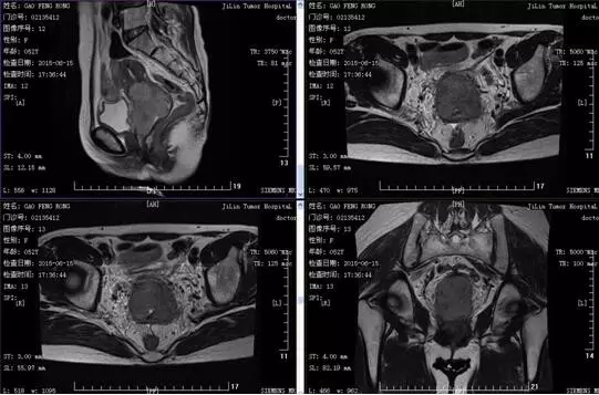 0c1c39171e299d8f7872d9bd19a8a13c.jpg 640.webp.jpg