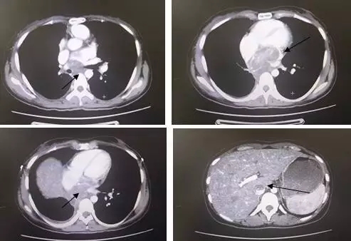 4b04dc6f8b060e82cd6b53128225ef80.jpg 640.webp (2).jpg