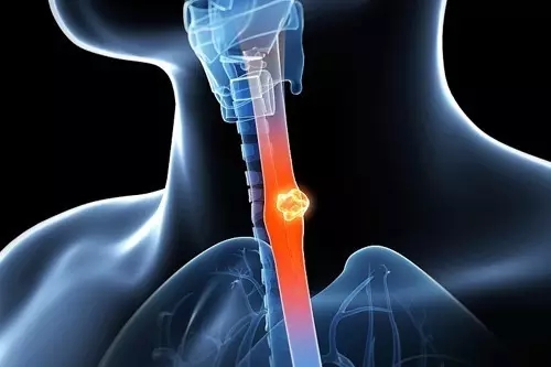 cd2f9b2f9cb86f6826b68f8b4b5e6702.jpg 640.webp (1).jpg