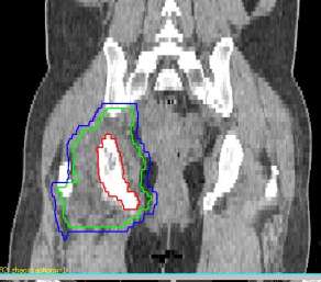 5bf892fae74a3afe0671a535f13bb16c.jpg IMG_2804.JPG