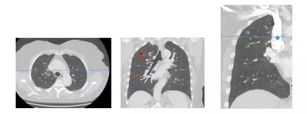 70b4ce22a53b9e26c1240bdf81e22b76.jpg 640.webp.jpg