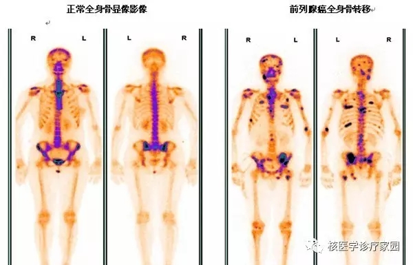 bf2df6789a7f5535851371245cc50fbc.jpg 640 (1).webp (1).jpg