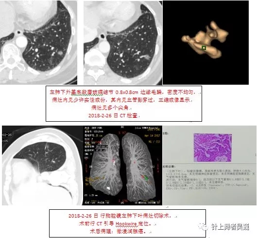 bb7b65097bad64c0fdf5a24c71c4b585.jpg 640.webp (28).jpg