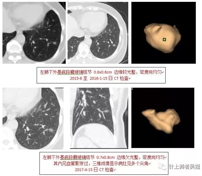 ffcdc466b24f2640c9b0888a53a2cb9f.jpg 640.webp (27).jpg