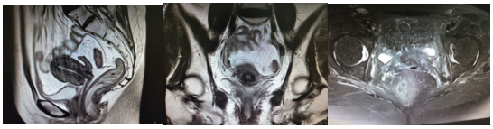 0dc5a4988b4931dd533165e612b07957.png 2.png