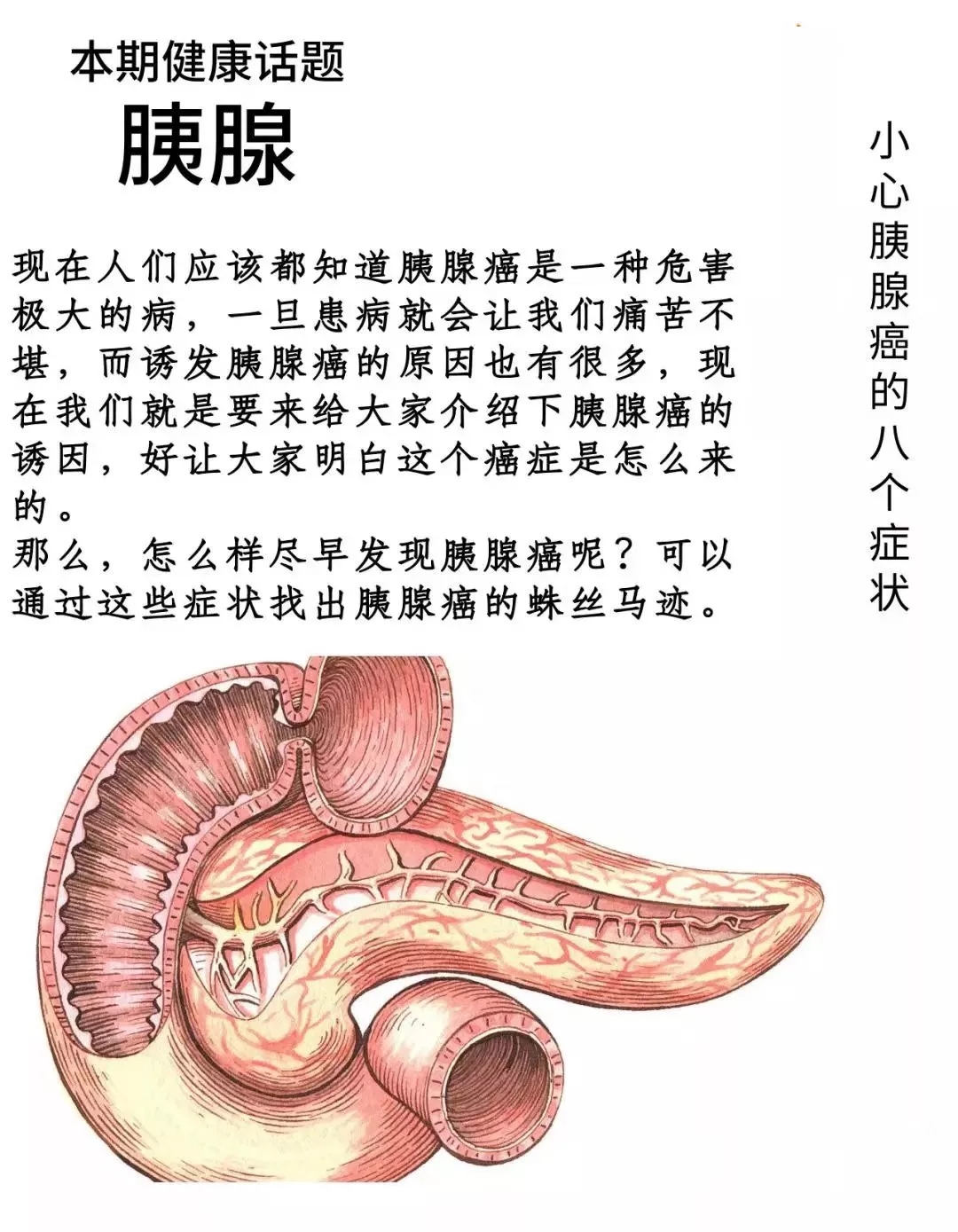 胰腺癌的早期症状女性图片