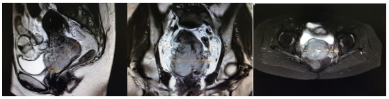 ce8b2b1f085bd60bf2e9159787a65224.png 0.png