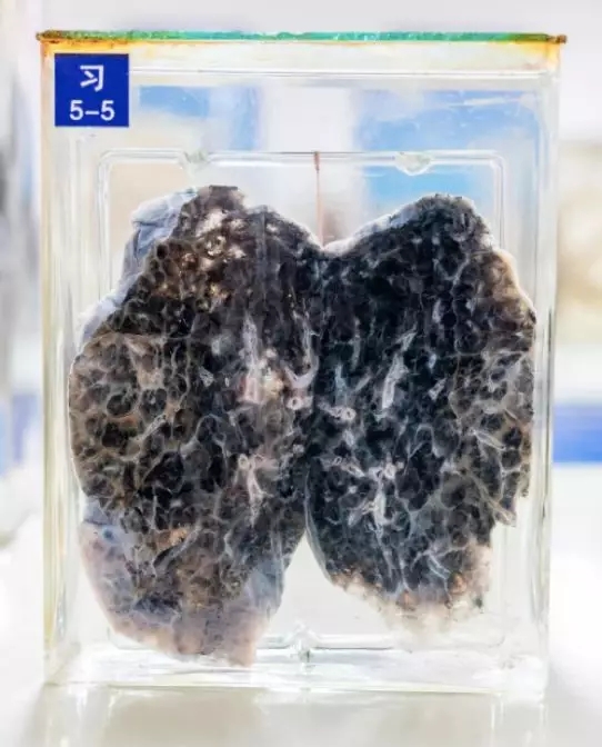 5097f1afecb4ce9e86e71668b06a8f1e.jpg 640.webp.jpg