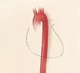 87dc3fa78e6e5aed121f185a70e53fb4.jpg 640.webp (7).jpg