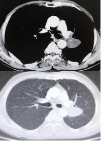 92f05bc3e2e5f64a02a47f0331ceead7.png 微信图片_20221220083936.png